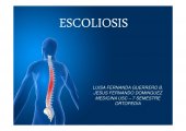 escoleosis